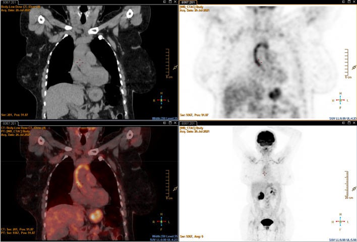 An external file that holds a picture, illustration, etc.
Object name is 11739_2021_2908_Fig1_HTML.jpg