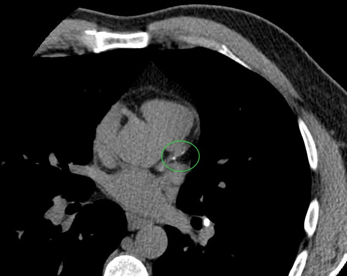 Screen Shot 2019-10-25 at 7.46.21 AM