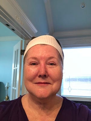 Ellen after the DIY treatment