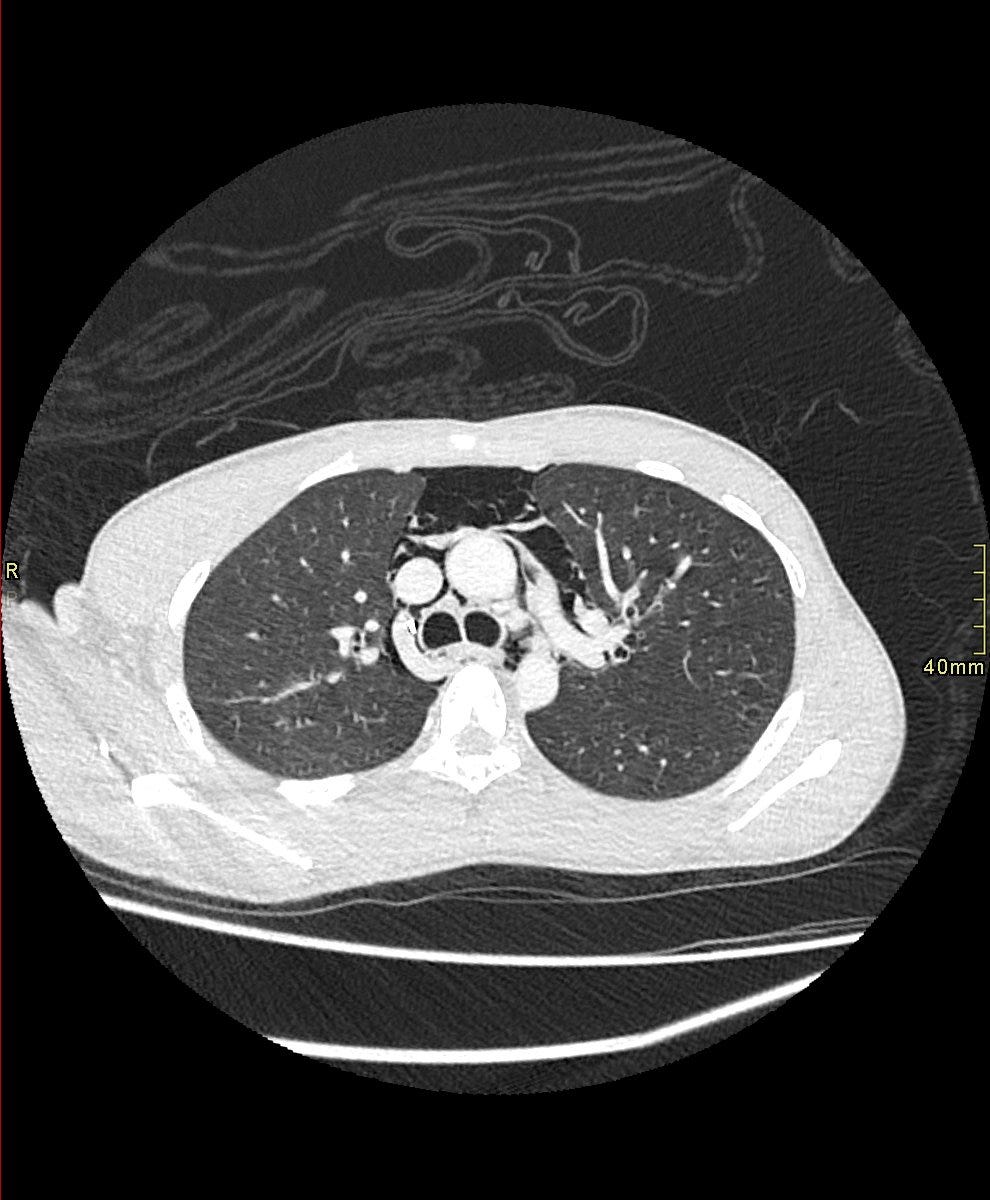A close-up of a ct scan
Description automatically generated