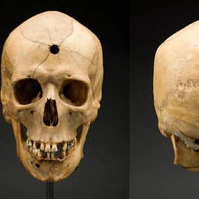 The Bones of Contention