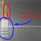 Τα εμβόλια COVID ενσωματώνονται στο ανθρώπινο DNA, σύμφωνα με μελέτη