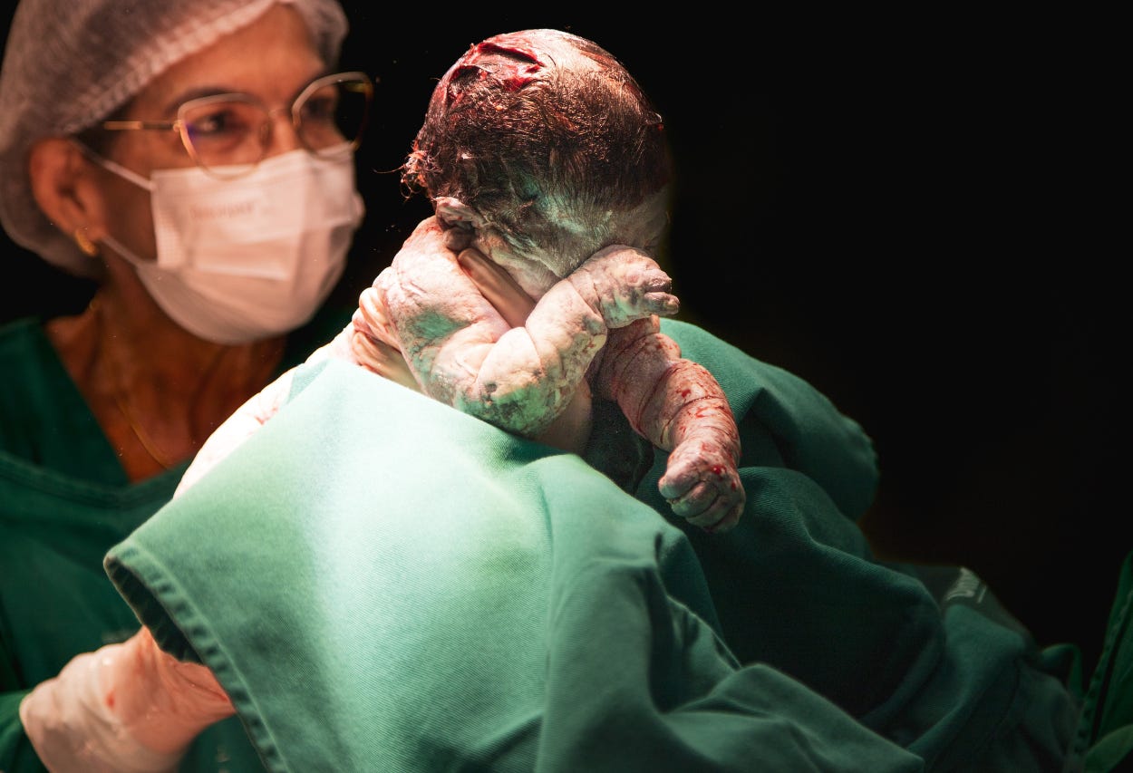Why American Childbirth Costs the Most and Delivers the Least