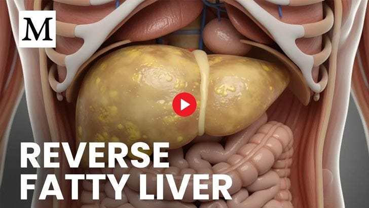 This Exercise Dose Shrinks Liver Fat Without Dieting This Exercise Dose Shrinks Liver Fat Without Dieting