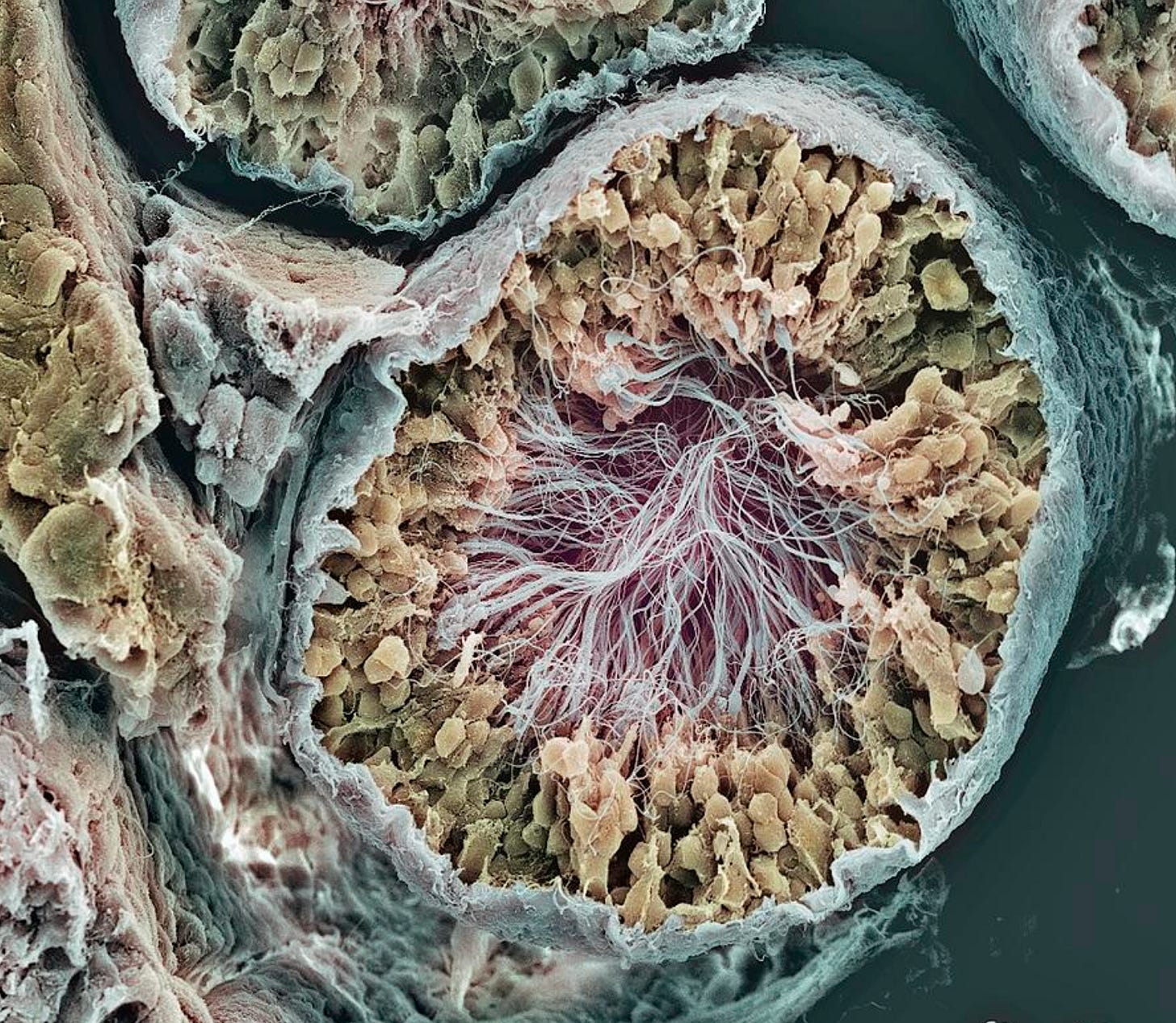 Sperm production site. Coloured scanning electron micrograph (SEM) of a freeze-fractured transverse section through a seminiferous tubule, the site of sperm production in the human testes Sperm production site. Coloured scanning electron micrograph (SEM) of a freeze-fractured transverse section through a seminiferous tubule, the site of sperm production in the human testes