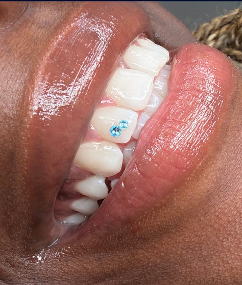 gemme dentali stili italia intervista