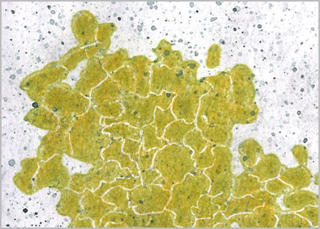I’m Likin’ Lichen!