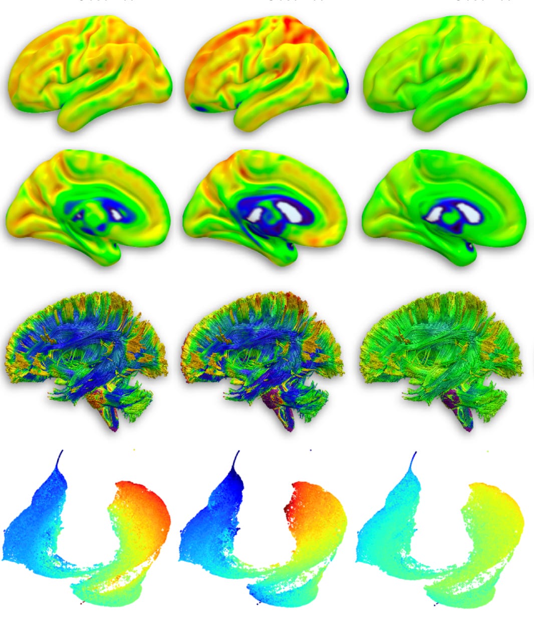 Probabilistic maps of mitochondrial features projected onto standard brain space Probabilistic maps of mitochondrial features projected onto standard brain space