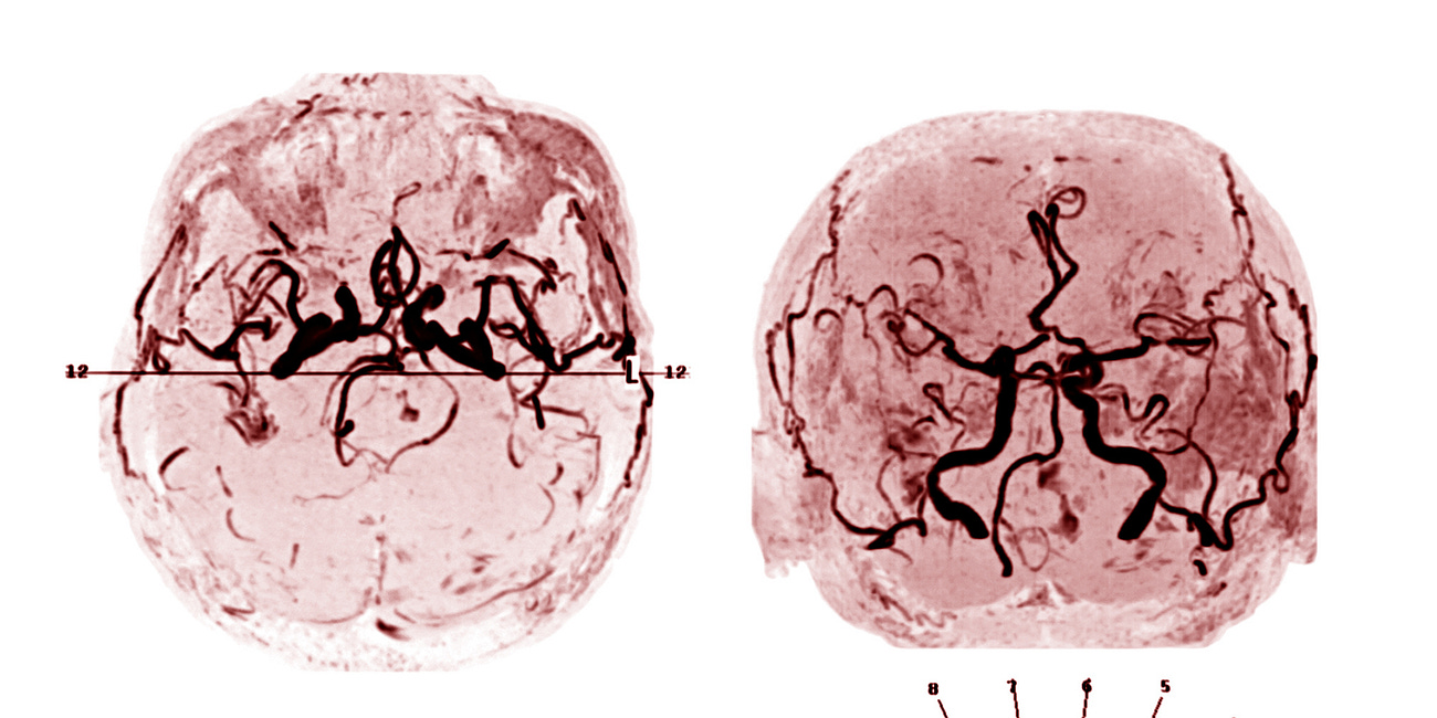 The Real-World Boards: Question #12