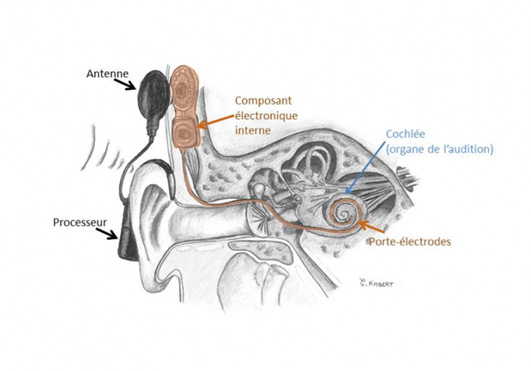 Le schéma de l'oreille interne est expliqué dans la légende Le schéma de l'oreille interne est expliqué dans la légende