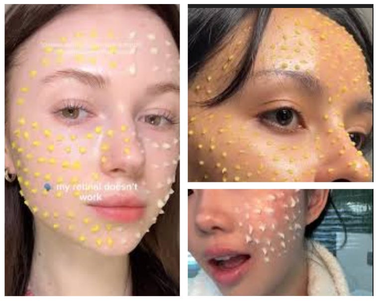 Retinol and retinal overused by Instagram influencers