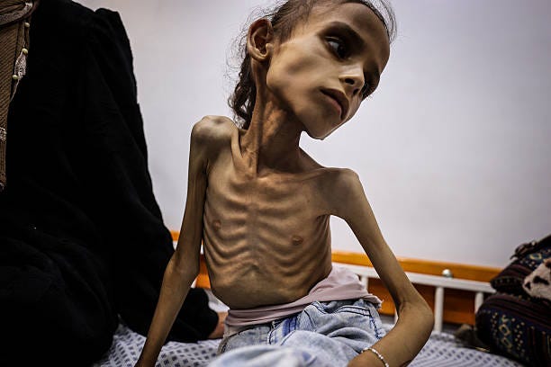 Year-old Maryam Duvvas, receiving treatment at Patient Friends Association Hospital is reported to be in critical condition due to severe...