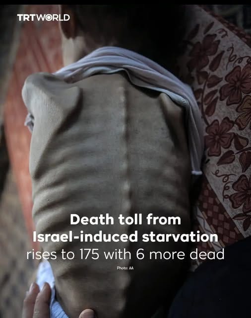 May be an image of 1 person and text that says "TRTWORLD Death toll from Israel Israel-induced starvation rises to 175 with 6 more dead Photo: AA" May be an image of 1 person and text that says "TRTWORLD Death toll from Israel Israel-induced starvation rises to 175 with 6 more dead Photo: AA"