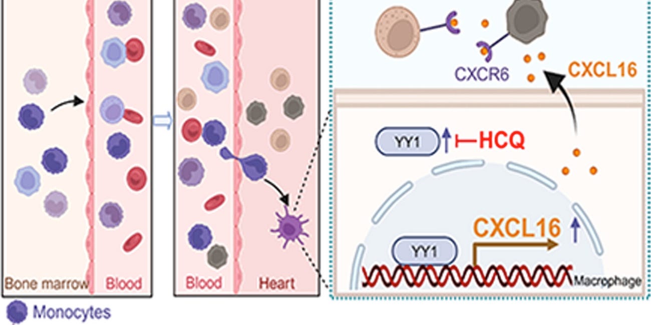 Hydroxychloroquine as Treatment Approach for Management of (Post-COVID "Vaccination") Myocarditis