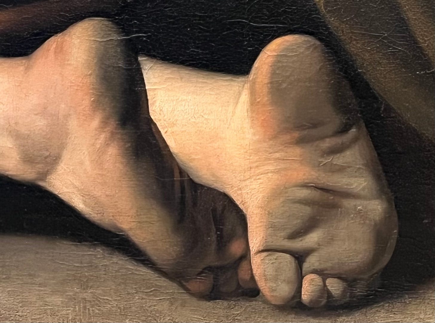 Close-up of a foot

Description automatically generated