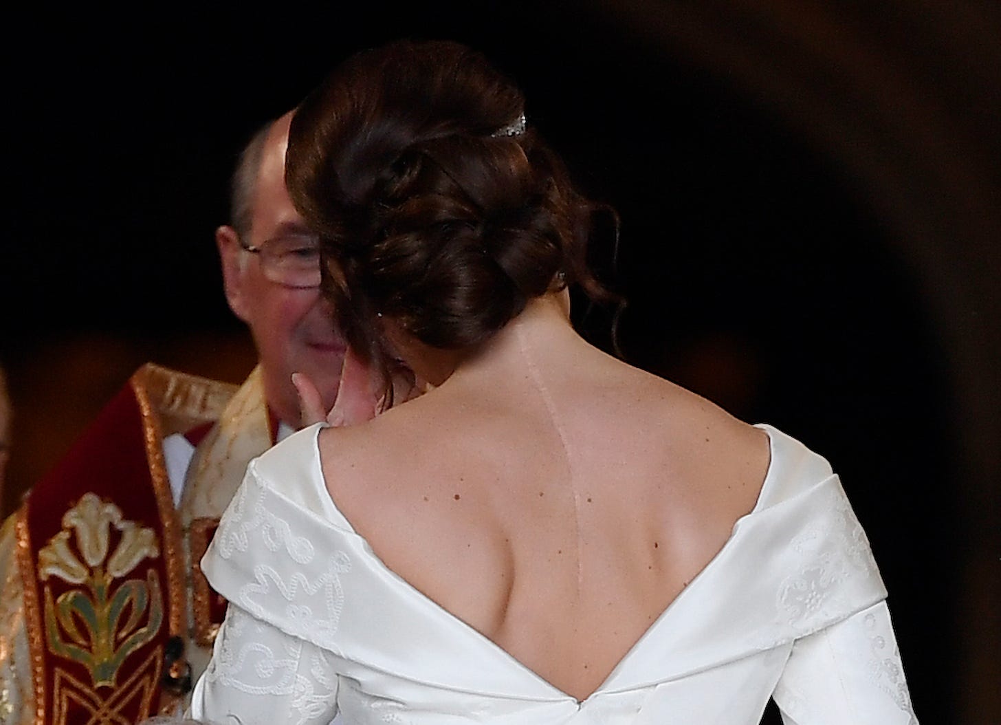 princess eugenie shows off scar on her back on her wedding day princess eugenie shows off scar on her back on her wedding day