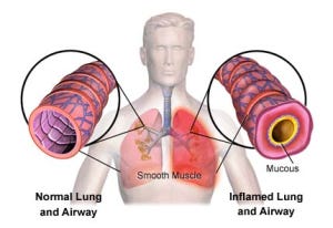 Sore lungs Sore lungs
