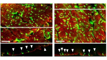 Perda de microbiota altera o perfil das células que protegem a parede do intestino