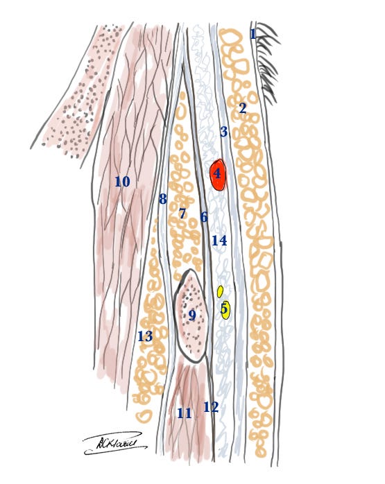Superficial Temporal Artery and the Temporal branch of the Facial Nerve: anatomical cross section to show the relative layers above the zygomatic arch 1 Superficial Temporal Artery and the Temporal branch of the Facial Nerve: anatomical cross section to show the relative layers above the zygomatic arch 1