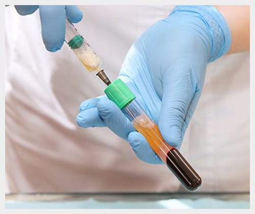 Prp injection | Prp Injection Therapy