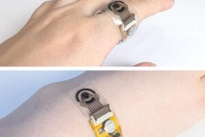 The fully integrated wireless wearable patch for long COVID monitoring. The scale bar shown for scale is 1 cm.