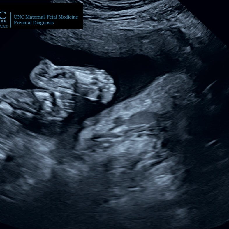 Because It's Natural