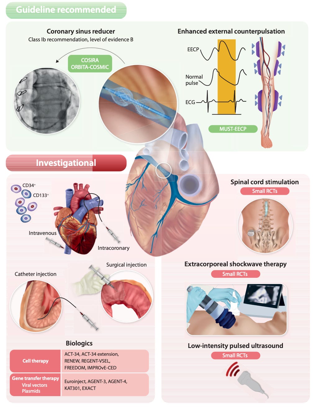 Angina refratária