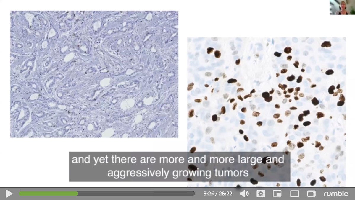 Dr. Ute Kruger on Turbo Cancer Dr. Ute Kruger on Turbo Cancer