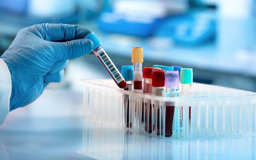 What Do Routine Blood Tests Check For? - Scripps Health
