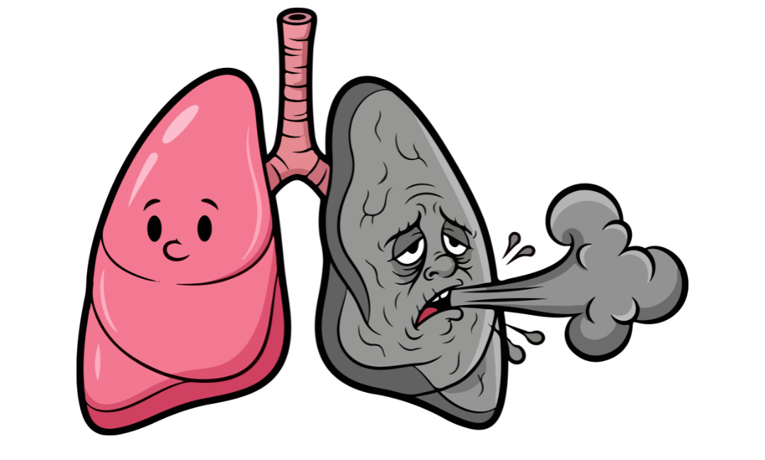 Company Developing Smoking Cessation therapy, Millions of People in need.