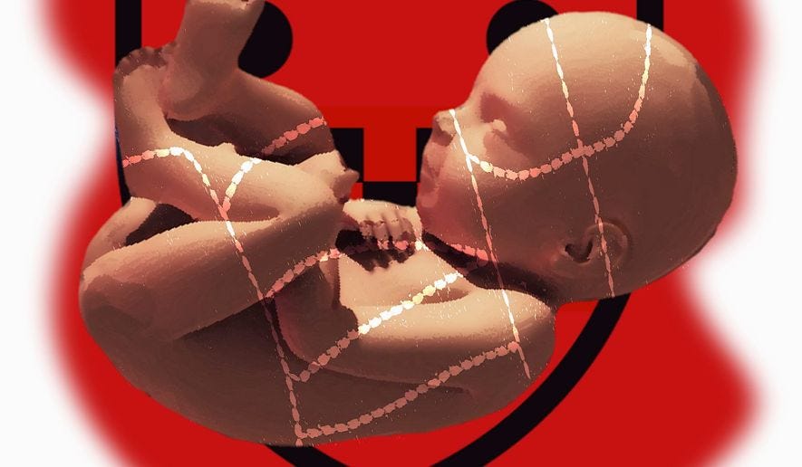 Illustration on harvesting aborted babies' tissue by Alexander Hunter/The Washington Times Illustration on harvesting aborted babies' tissue by Alexander Hunter/The Washington Times