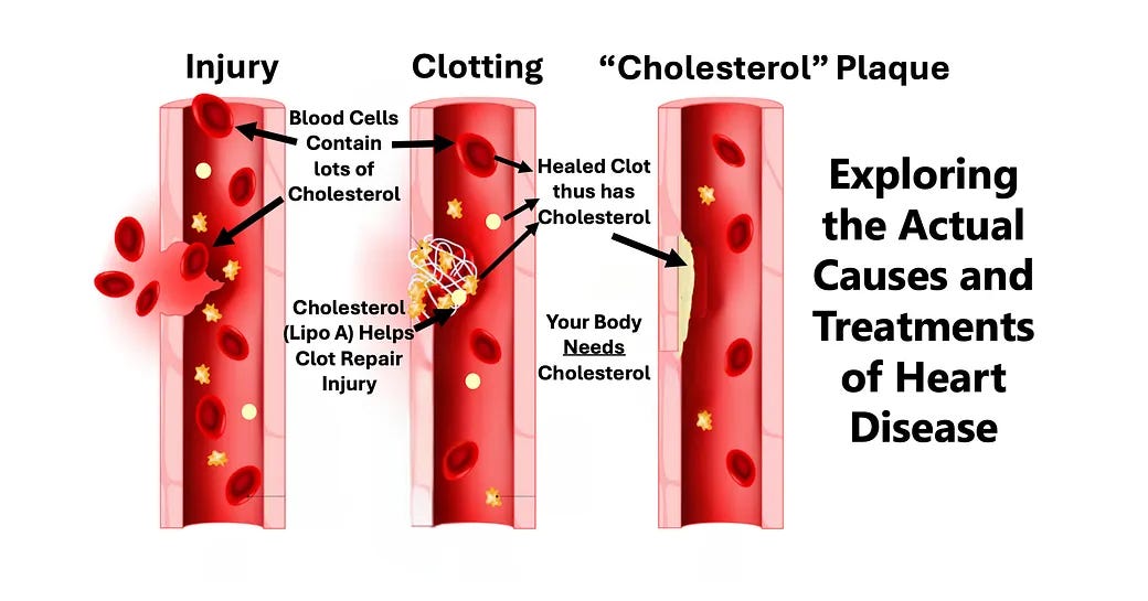 The Great Cholesterol Lie and The Dangers of Statins
