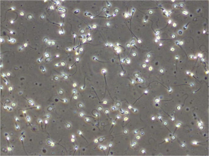 Machine Learning-Based Analysis of Sperm Videos and Participant Data for Male Fertility Prediction | Scientific Reports Machine Learning-Based Analysis of Sperm Videos and Participant Data for Male Fertility Prediction | Scientific Reports