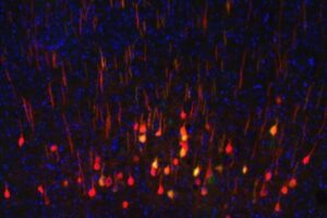 Neurons