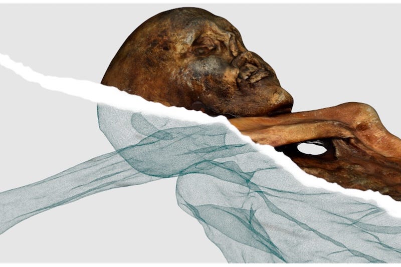 Ötzi's digital twin, with the photogrammetric skin above and the CT-derived skeleton below.