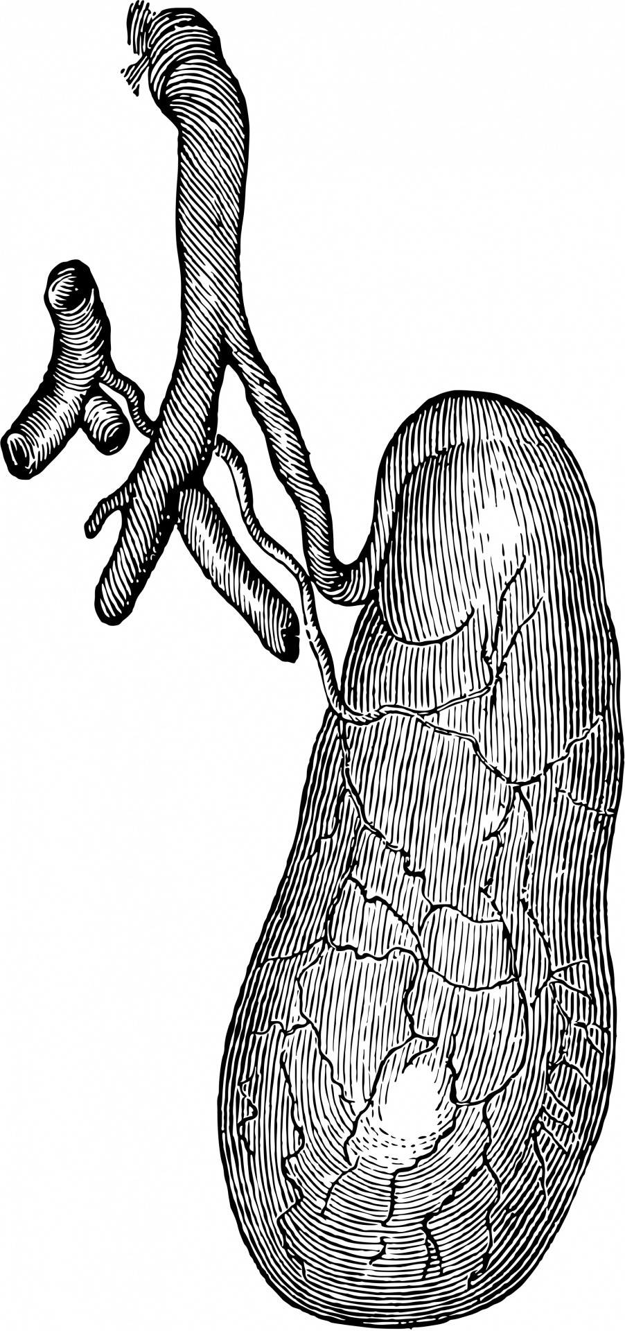 Gall Bladder Gall Bladder