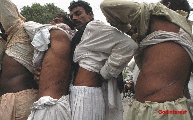 Organ trafficking