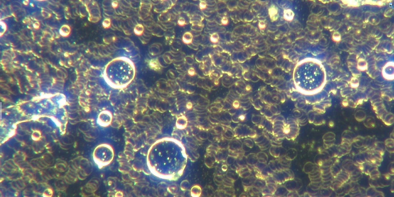 Nanobot and Microrobot Micellar Mesh Network Transforming COVID19 Unvaccinated Teenage Blood