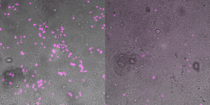 Two side by side gifs. On the left, a growing number of pink speckles indicate venom toxins are killing cells. On the right, fewer pink speckles indicate that designer proteins are protecting cells from toxins. Two side by side gifs. On the left, a growing number of pink speckles indicate venom toxins are killing cells. On the right, fewer pink speckles indicate that designer proteins are protecting cells from toxins.
