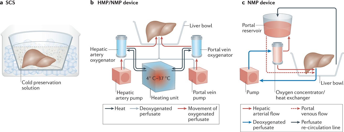 Machine perfusion of the liver: applications in transplantation and beyond | Nature Reviews Gastroenterology & Hepatology Machine perfusion of the liver: applications in transplantation and beyond | Nature Reviews Gastroenterology & Hepatology