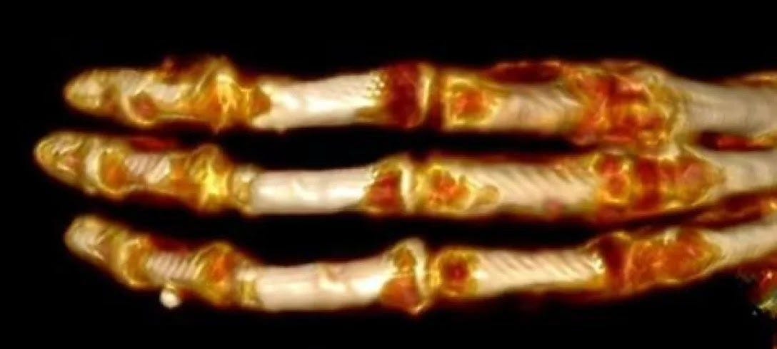 A largura dos ossos do pulso e as bases dos três dedos mudam suave e uniformemente, tornando as mãos tão largas quanto as de uma pessoa. Cada dedo da mão possui quatro falanges, ao contrário das três falanges dos humanos A largura dos ossos do pulso e as bases dos três dedos mudam suave e uniformemente, tornando as mãos tão largas quanto as de uma pessoa. Cada dedo da mão possui quatro falanges, ao contrário das três falanges dos humanos