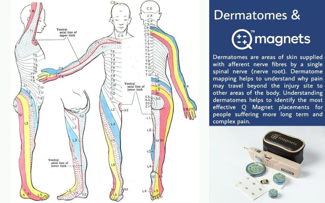 q magnets and dermatomes