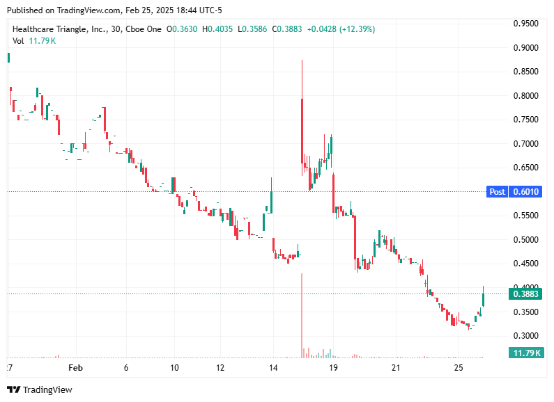TradingView chart TradingView chart