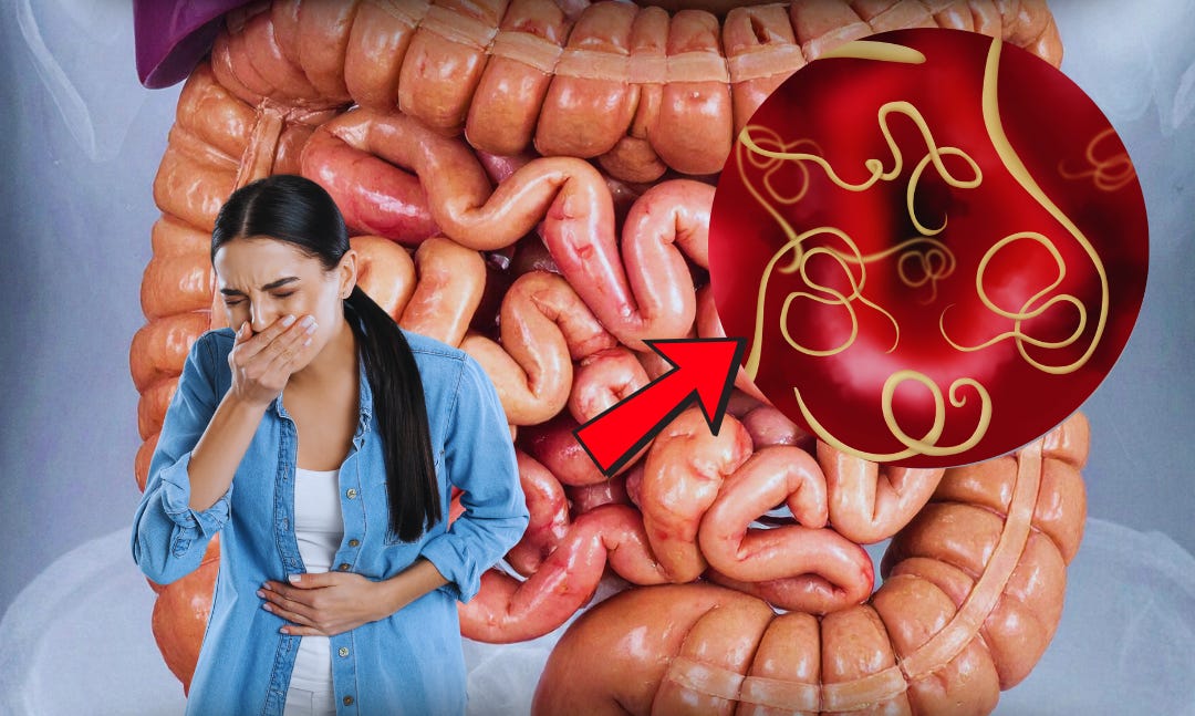 10 sintomas de vermes intestinais - Mais Saúde Blue
