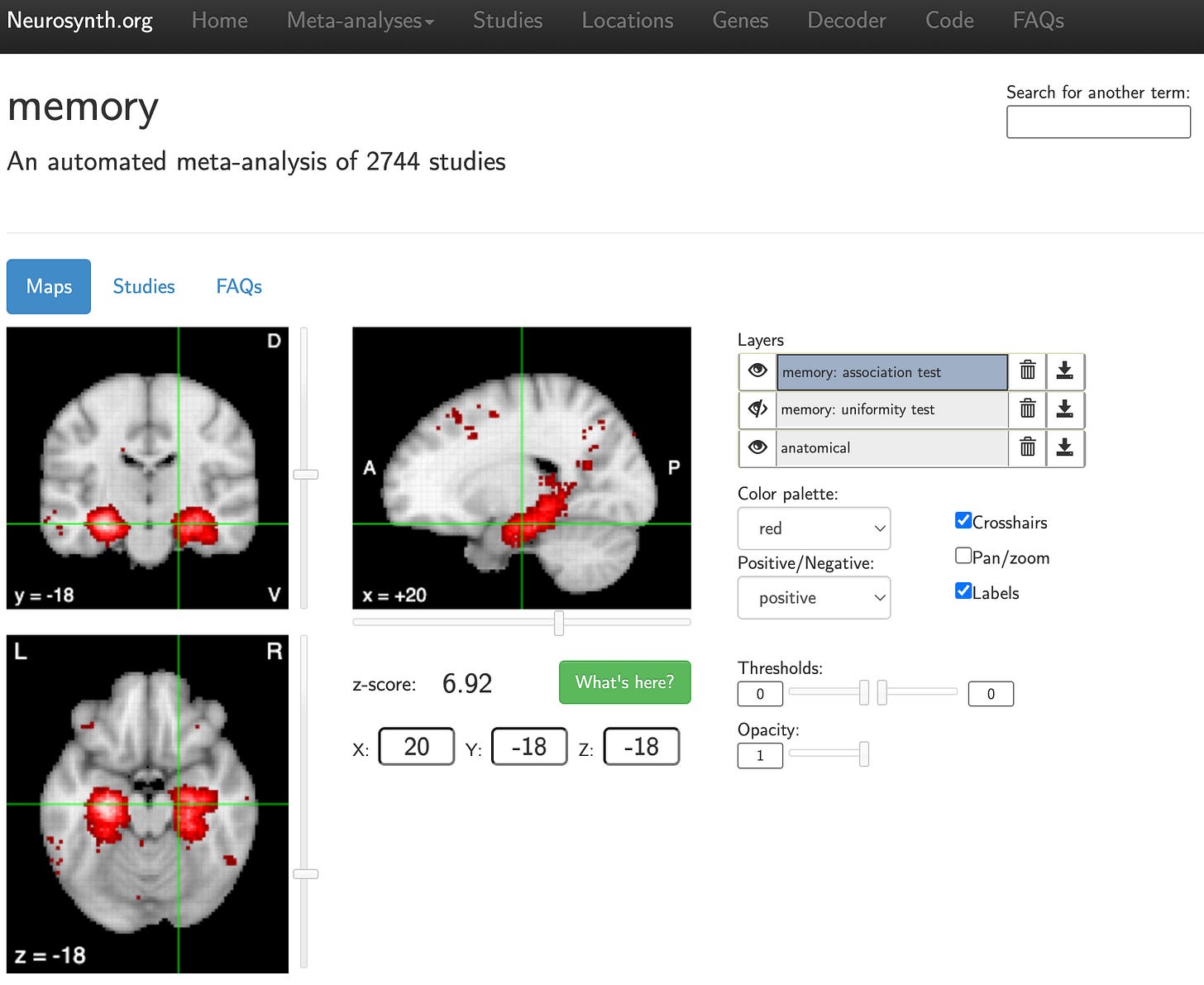 Screenshot of an automatically-generated meta-analytical synthesis of 2,744 studies showing a co-activation map for the term “memory” using Neurosynth Screenshot of an automatically-generated meta-analytical synthesis of 2,744 studies showing a co-activation map for the term “memory” using Neurosynth