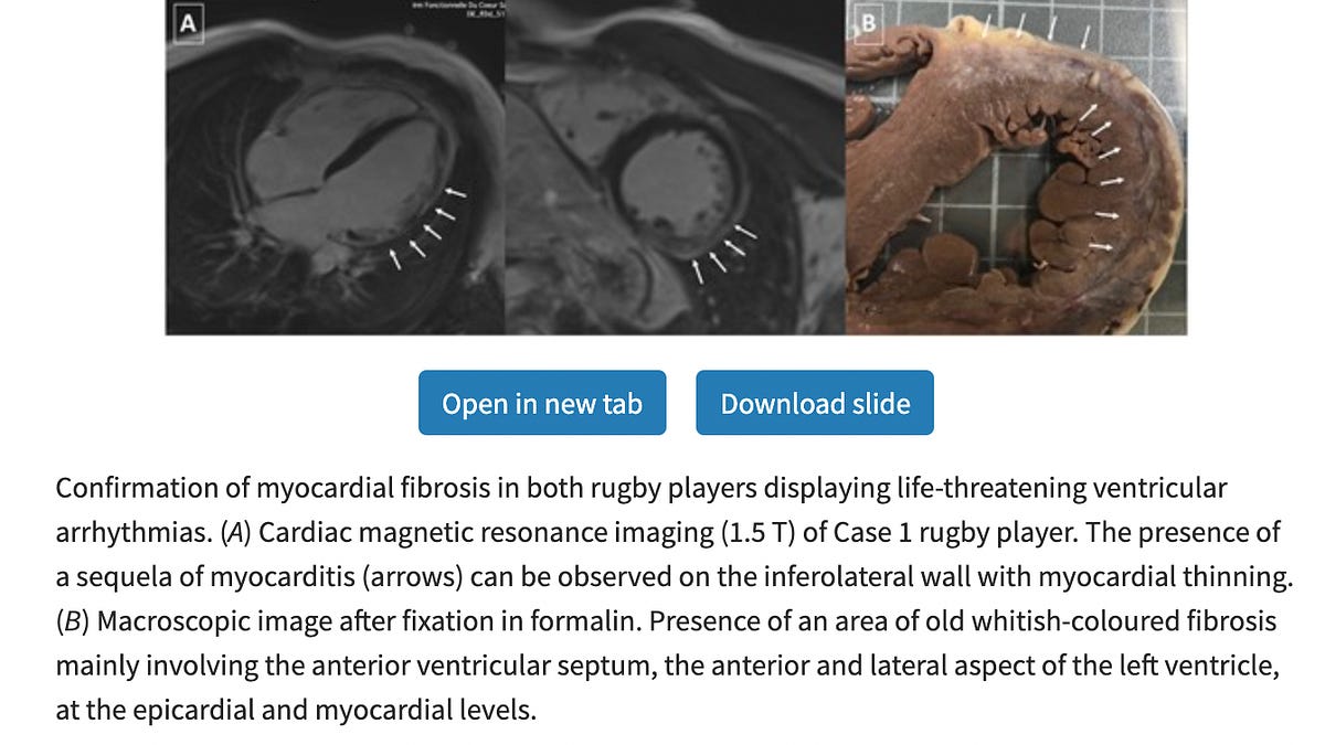 petermcculloughmd.substack.com