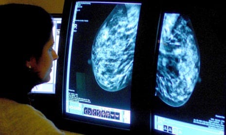 A consultant analyses a mammogram A consultant analyses a mammogram