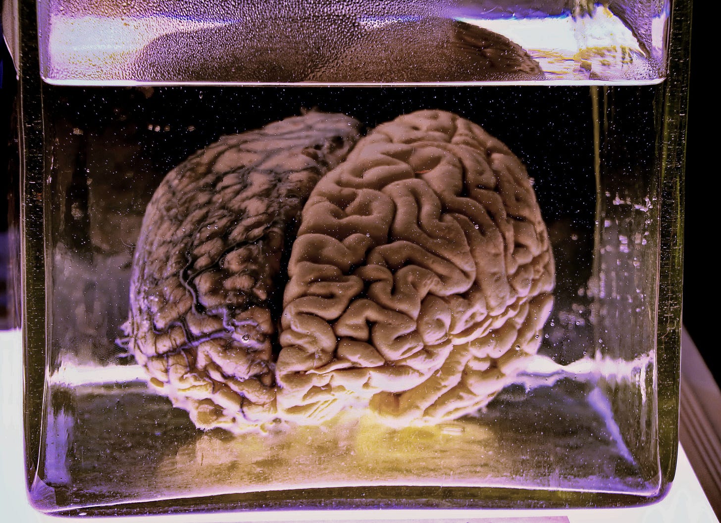 A preserved brain (Keni/shutterstock.com) A preserved brain (Keni/shutterstock.com)