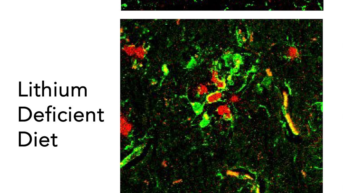 Lithium and Its Potential Protection from Alzheimer's Disease