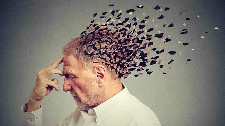 us alzheimers disease deaths increase
